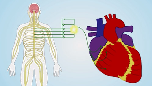 screenshot from a YouTube video demonstrating the role of the spinal cord in regulating myocardial sympathoexcitation